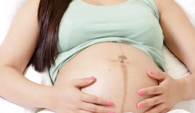 أسباب وجود خط داكن على بطن الحامل