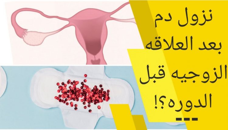 أسباب نزول دم بعد العلاقة الزوجية قبل الدورة