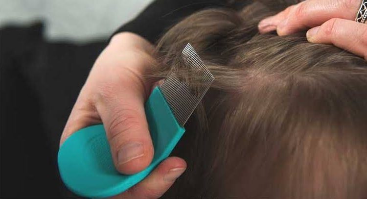 افضل شامبو للقمل والصيبان من الصيدلية