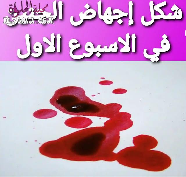 شكل اجهاض الجنين في الاسبوع الاول