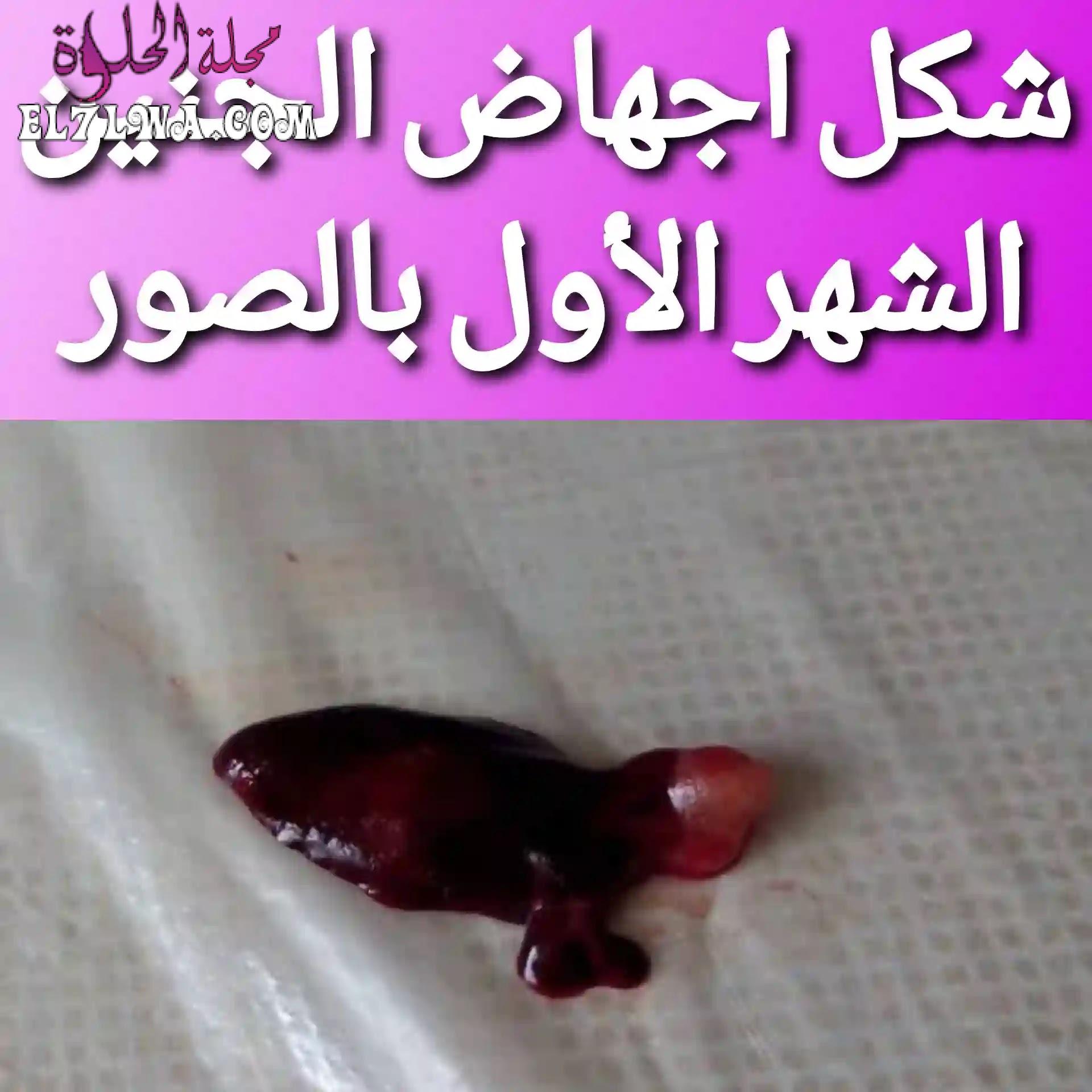 شكل الجنين في الشهر الاول بعد الاجهاض