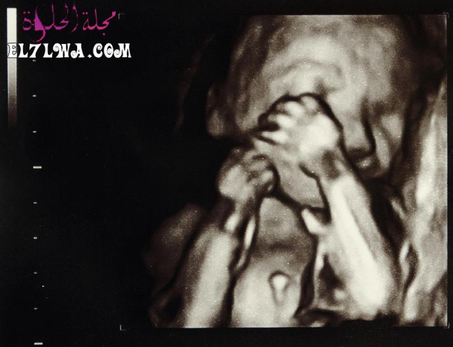 صورة ثلاثية الأبعاد لشكل الجنين في الشهر السادس